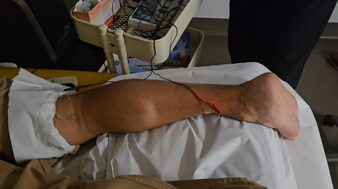 Fisioterapia Postquirúrgica en Oviedo